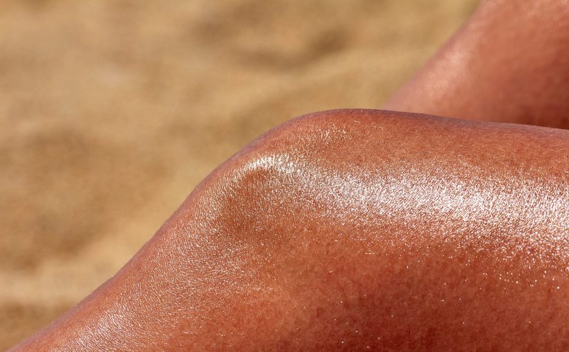 Sunburn Aftercare Tips
