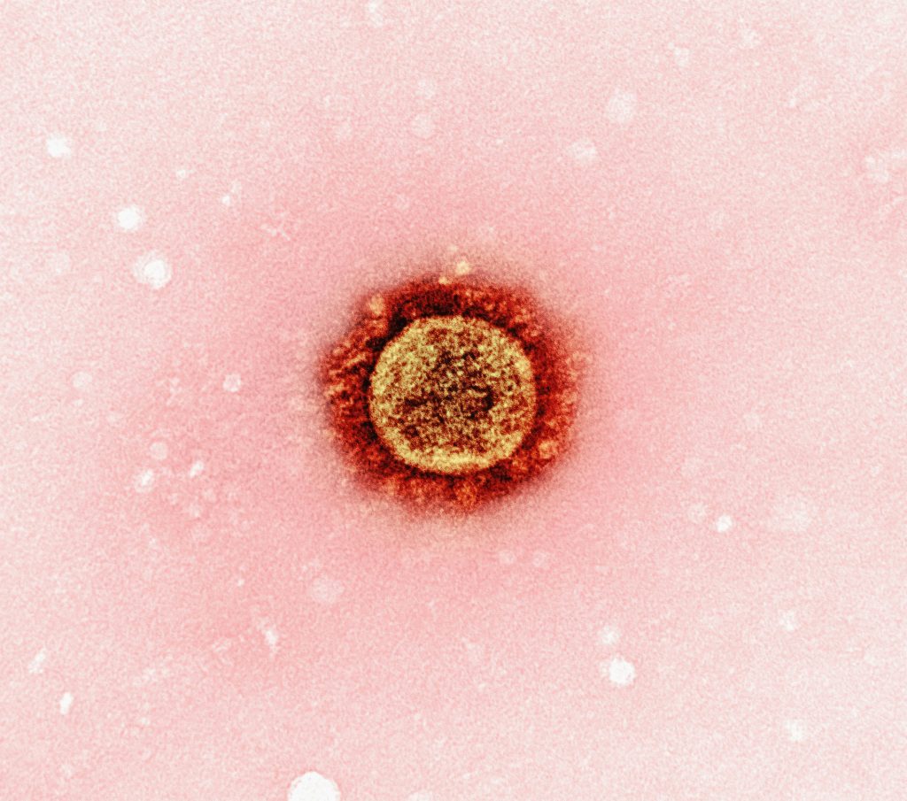 Measles